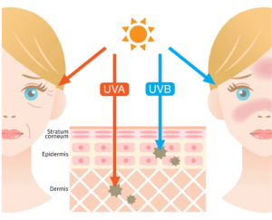 UVA vs UVB