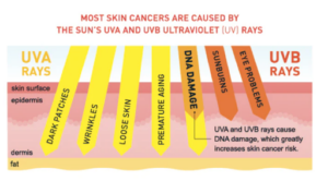 Most skin Cancers are caused by UVA and UVB